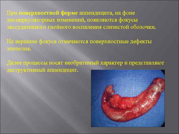 При поверхностной форме аппендицита, на фоне дисциркуляторных изменений, появляются фокусы экссудативного гнойного воспаления слизистой