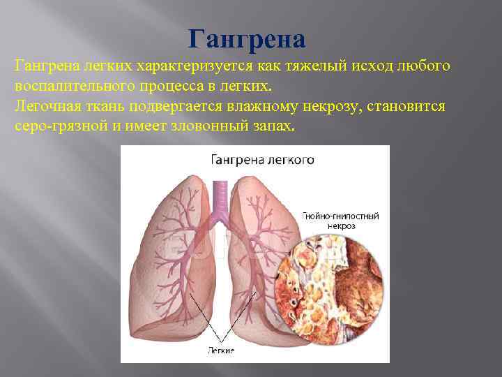 Гангрена легких характеризуется как тяжелый исход любого воспалительного процесса в легких. Легочная ткань подвергается