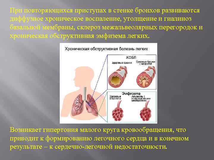 Стенки бронхов