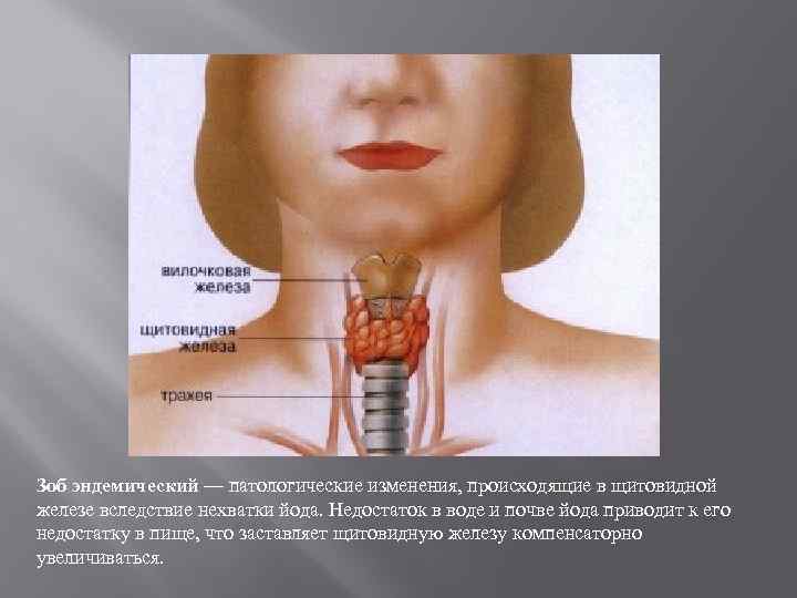 Диффузные изменения щитовидной железы