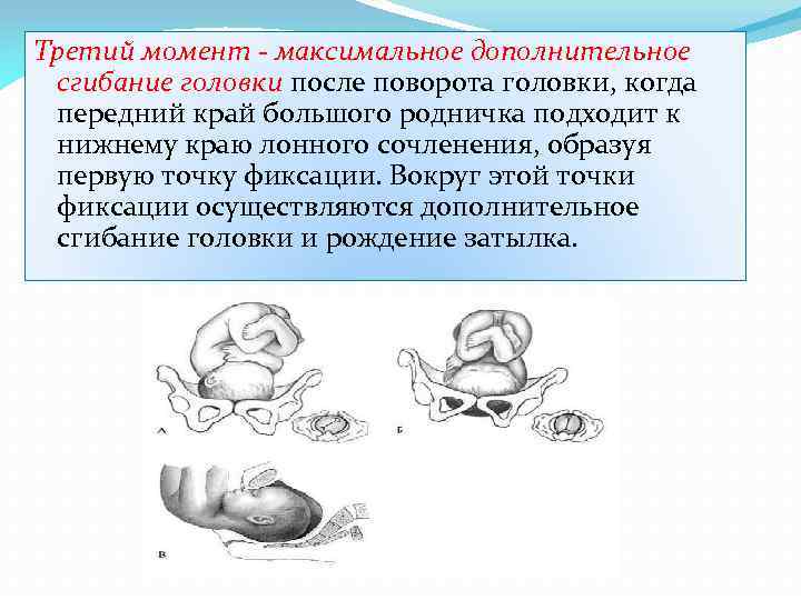 Третий момент - максимальное дополнительное сгибание головки после поворота головки, когда передний край большого
