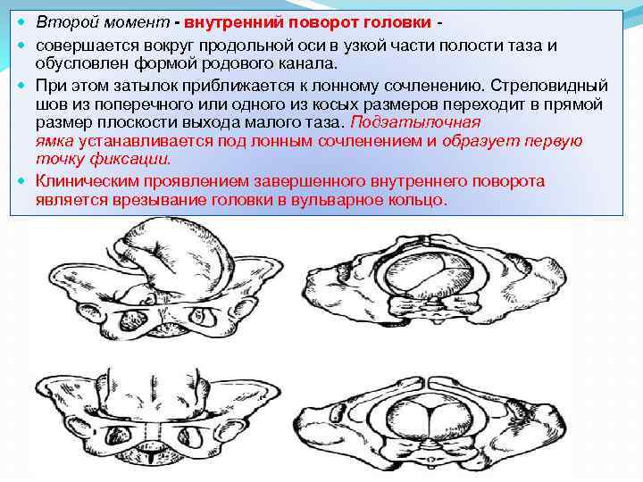  Второй момент - внутренний поворот головки совершается вокруг продольной оси в узкой части