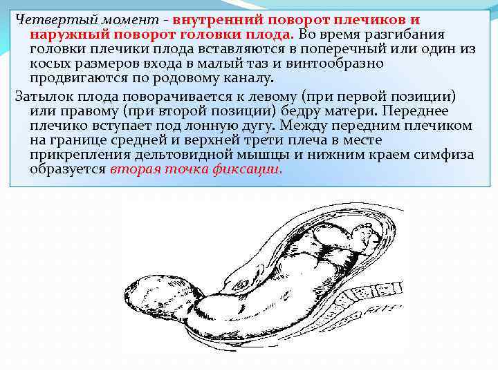 Четвертый момент - внутренний поворот плечиков и наружный поворот головки плода. Во время разгибания