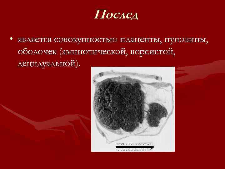 Послед • является совокупностью плаценты, пуповины, оболочек (амниотической, ворсистой, децидуальной). 