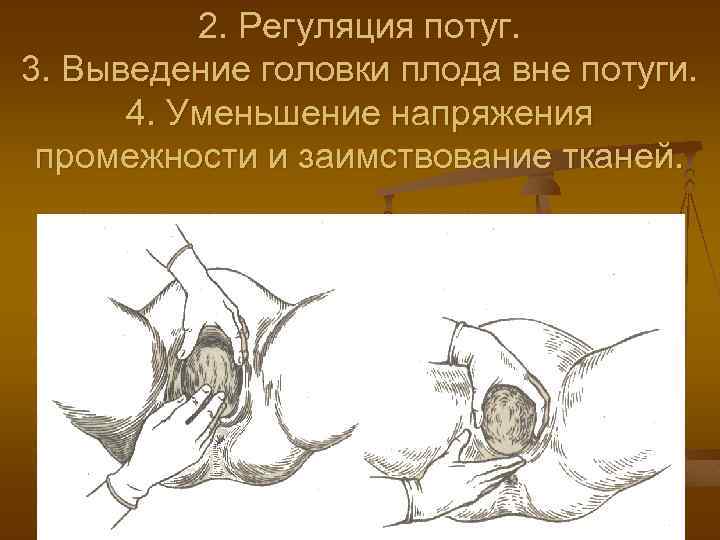 2. Регуляция потуг. 3. Выведение головки плода вне потуги. 4. Уменьшение напряжения промежности и