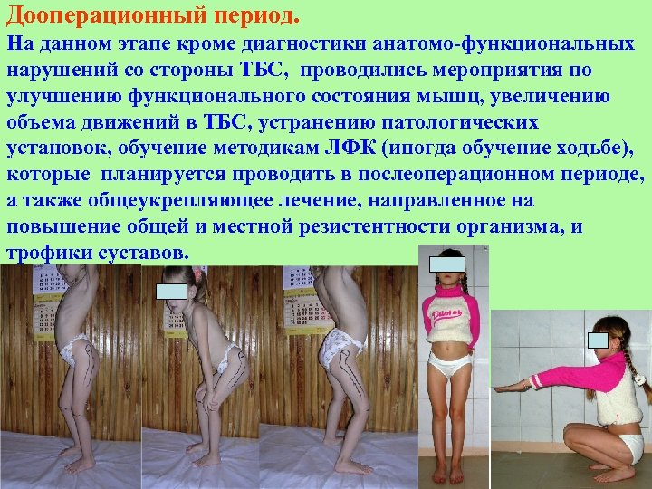 Дооперационный период. На данном этапе кроме диагностики анатомо-функциональных нарушений со стороны ТБС, проводились мероприятия