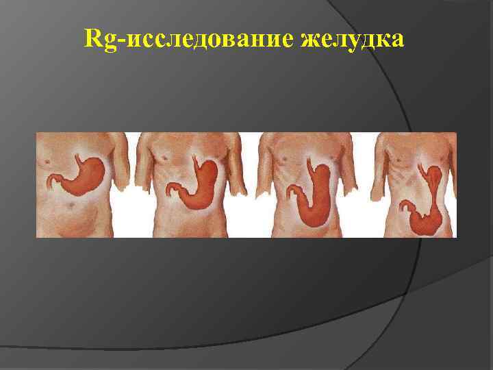 Rg-исследование желудка 