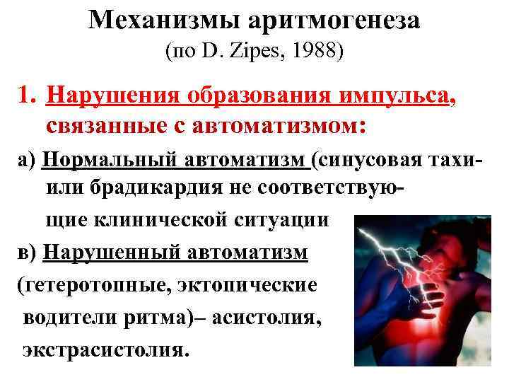 Механизмы аритмогенеза (по D. Zipes, 1988) 1. Нарушения образования импульса, связанные с автоматизмом: а)