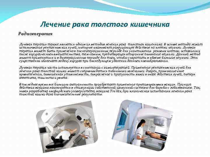 Лечение рака толстого кишечника Радиотерапия Лучевая терапия также является одним из методов лечения рака