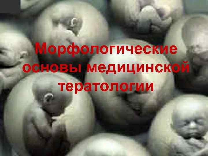 Морфологические основы медицинской тератологии 