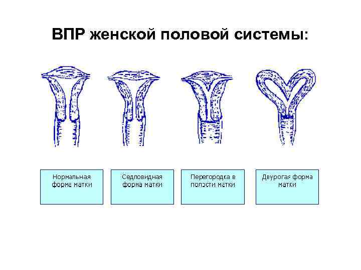ВПР женской половой системы: 