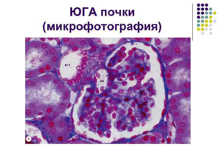 ЮГА почки (микрофотография) 