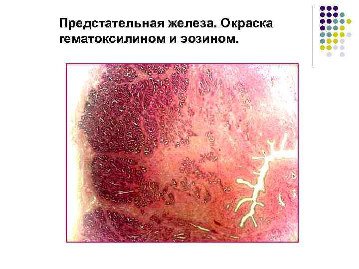 Предстательная железа. Окраска гематоксилином и эозином. 