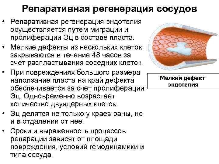 Репаративная регенерация сосудов • Репаративная регенерация эндотелия осуществляется путем миграции и пролиферации Эц в