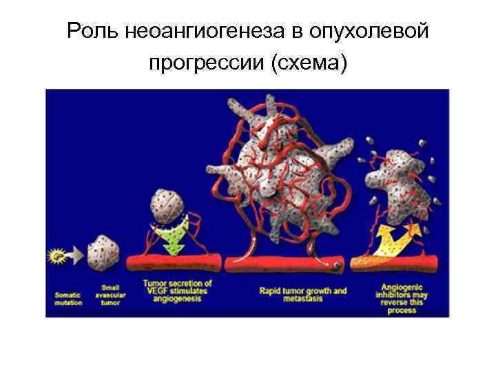Роль неоангиогенеза в опухолевой прогрессии (схема) 