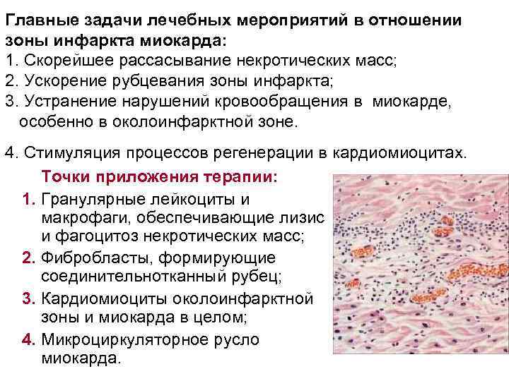 Главные задачи лечебных мероприятий в отношении зоны инфаркта миокарда: 1. Скорейшее рассасывание некротических масс;
