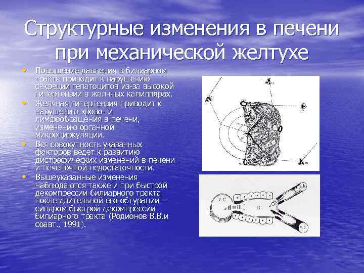 Структурные изменения в печени при механической желтухе • Повышение давления в билиарном • •