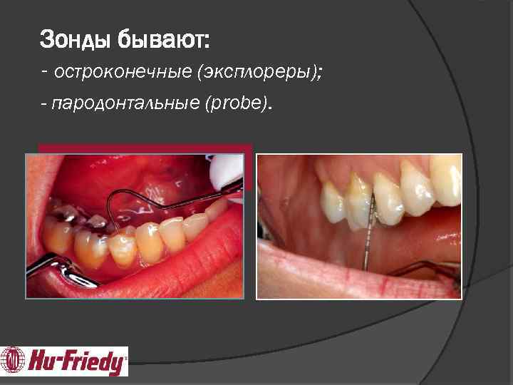 Зонды бывают: - остроконечные (эксплореры); - пародонтальные (probe). 