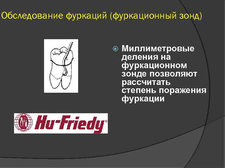 Обследование фуркаций (фуркационный зонд) Миллиметровые деления на фуркационном зонде позволяют рассчитать степень поражения фуркации