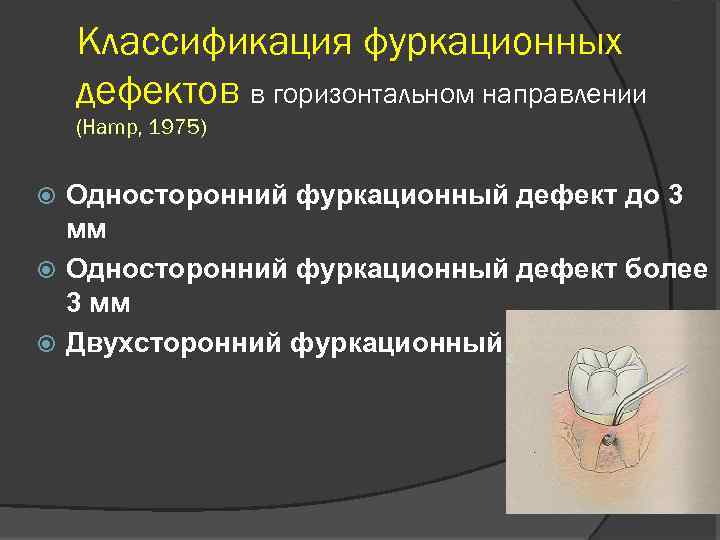 Дефект 3. Классы фуркационных дефектов. Фуркационный дефект классификация. Фуркационный дефект альвеолярной кости.