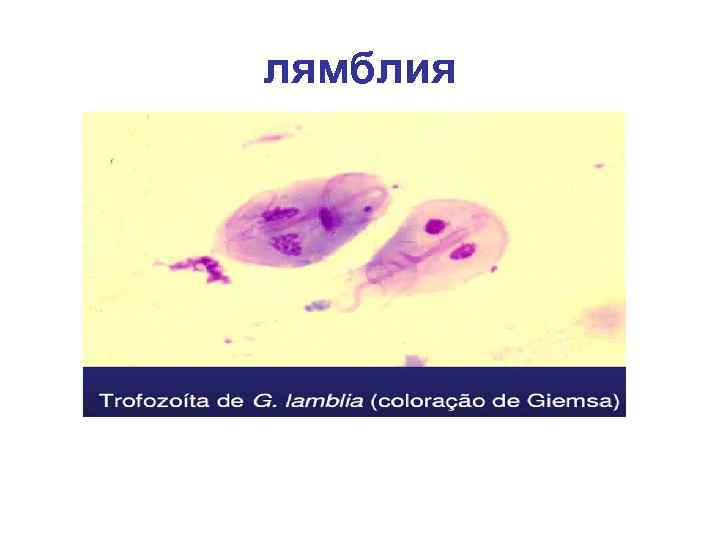 лямблия 