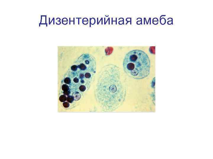 Дизентерийная амеба 