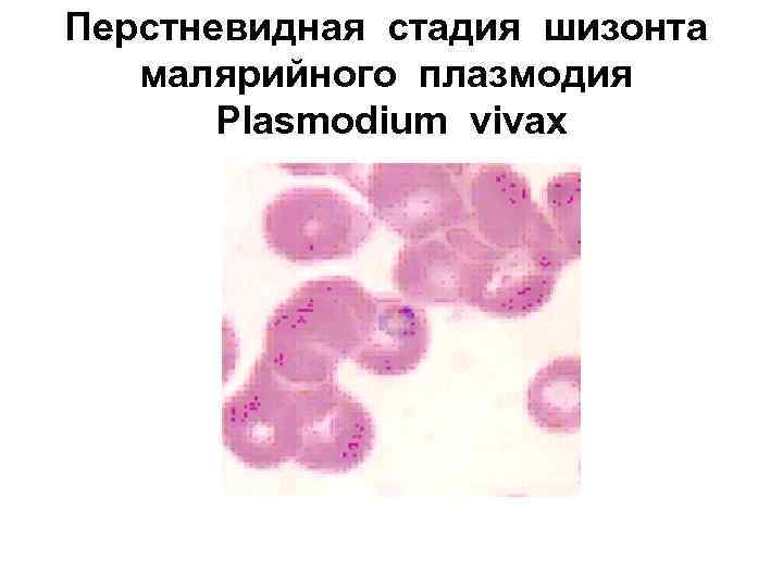 Перстневидная стадия шизонта малярийного плазмодия Plasmodium vivax 