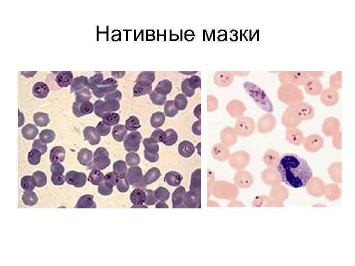 Нативные мазки 