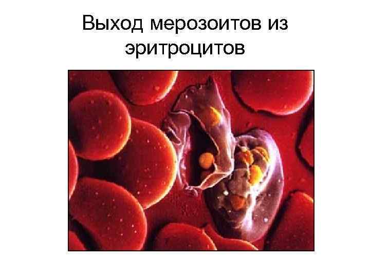 Выход мерозоитов из эритроцитов 