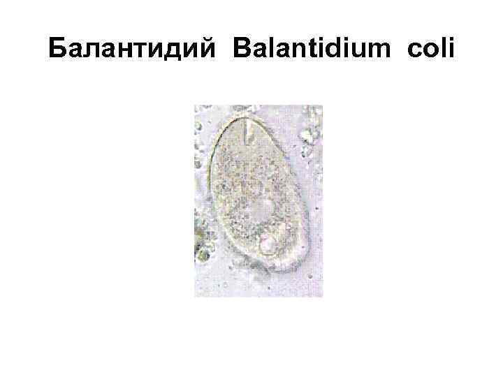 Балантидий Balantidium coli 