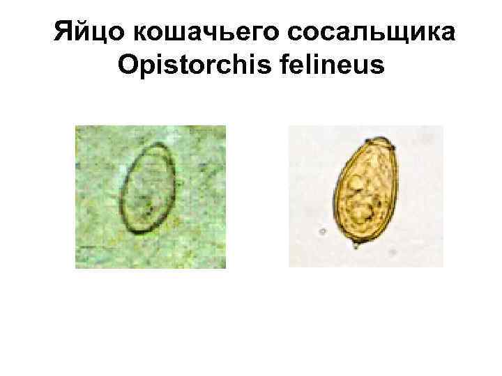  Яйцо кошачьего сосальщика Opistorchis felineus 