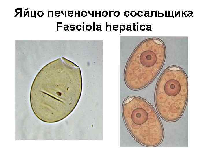 Яйцо печеночного сосальщика Fasciola hepatica 