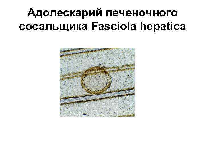 Адолескарий печеночного сосальщика Fasciola hepatica 