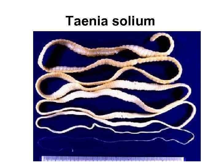 Taenia solium 