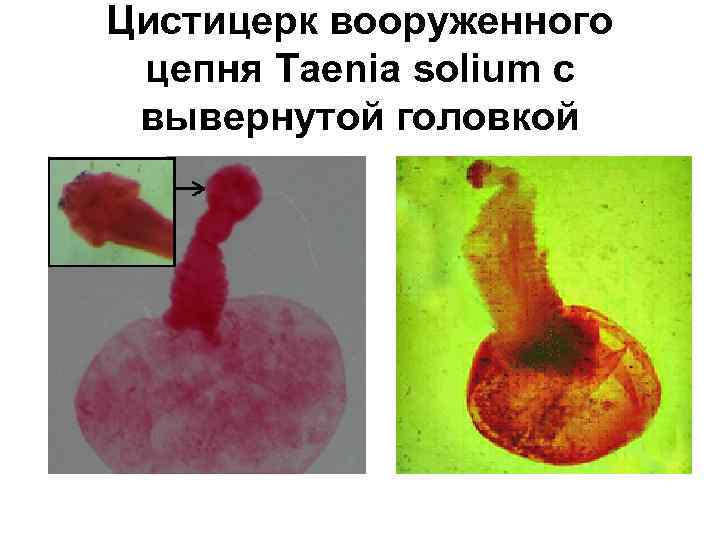 Цистицерк вооруженного цепня Taenia solium с вывернутой головкой 
