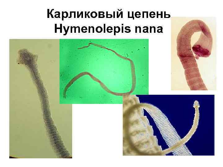 Карликовый цепень Hymenolepis nana 