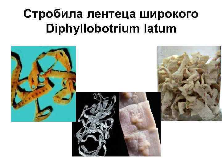 Стробила лентеца широкого Diphyllobotrium latum 