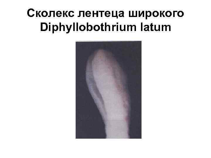 Сколекс лентеца широкого Diphyllobothrium latum 