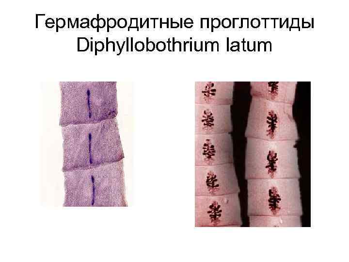 Гермафродитные проглоттиды Diphyllobothrium latum 