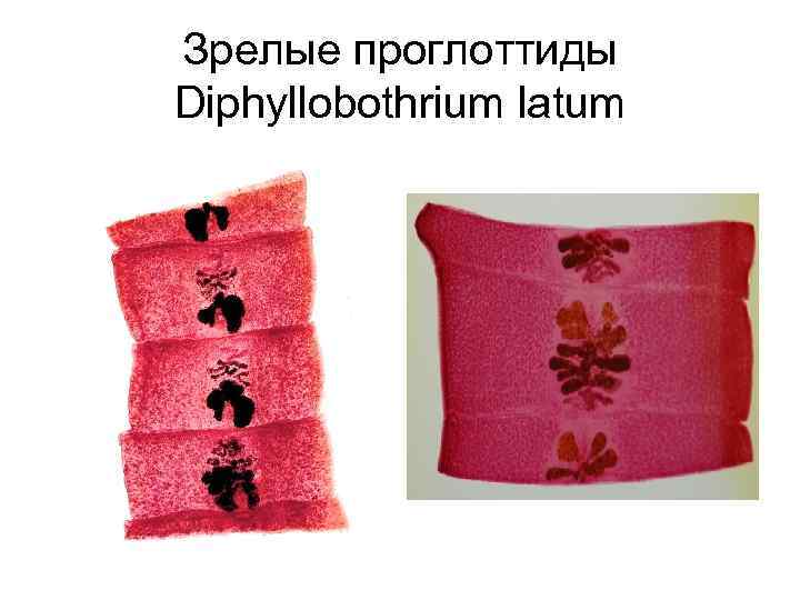 Зрелые проглоттиды Diphyllobothrium latum 