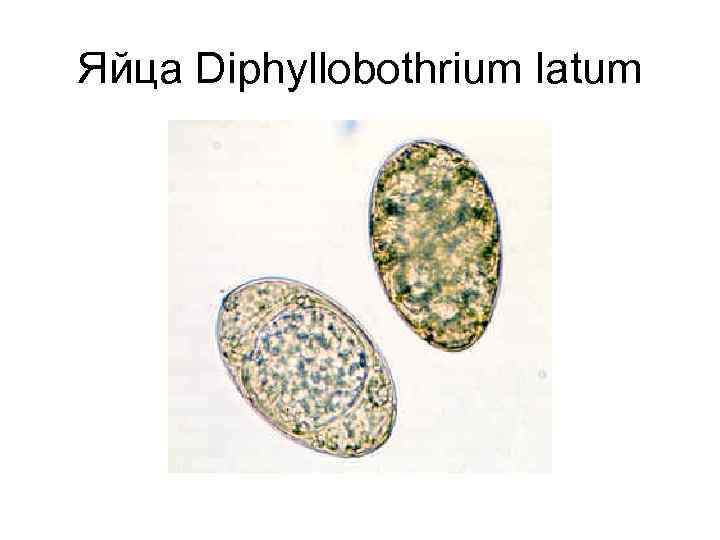 Яйца Diphyllobothrium latum 