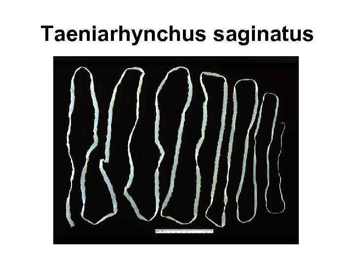 Taeniarhynchus saginatus 