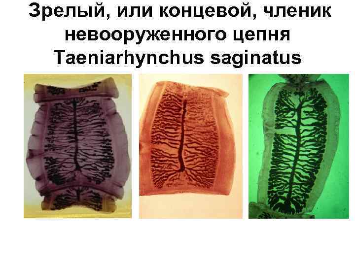  Зрелый, или концевой, членик невооруженного цепня Taeniarhynchus saginatus 