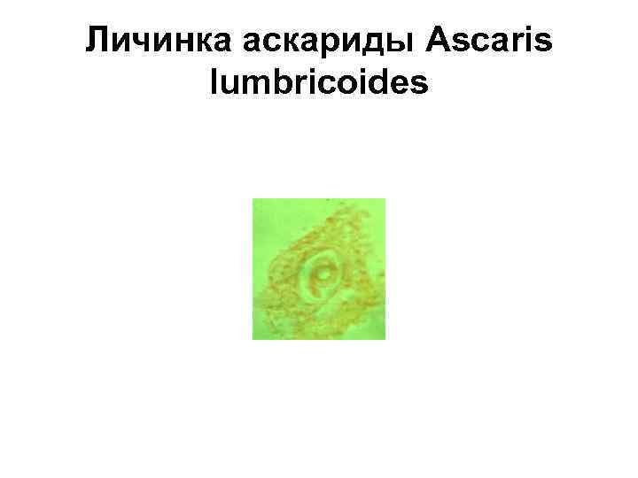 Личинка аскариды Ascaris lumbricoides 