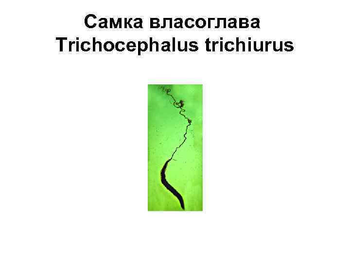 Самка власоглава Trichocephalus trichiurus 