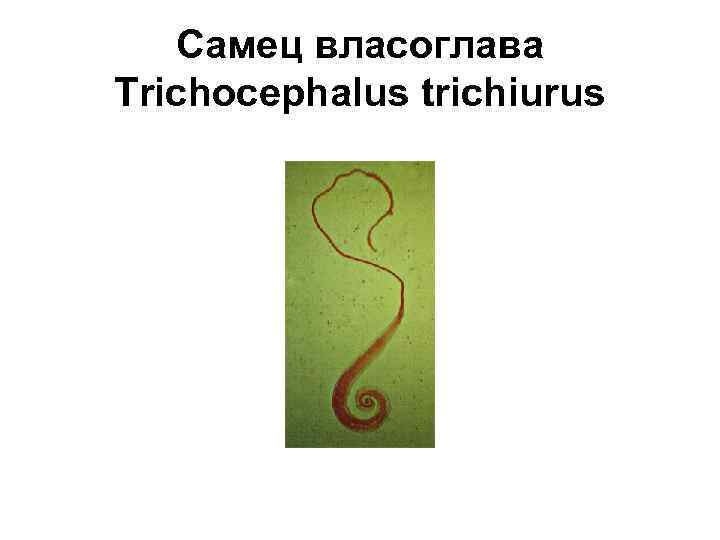 Самец власоглава Trichocephalus trichiurus 