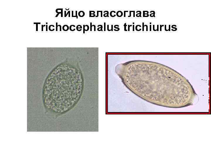 Яйцо власоглава Trichocephalus trichiurus 