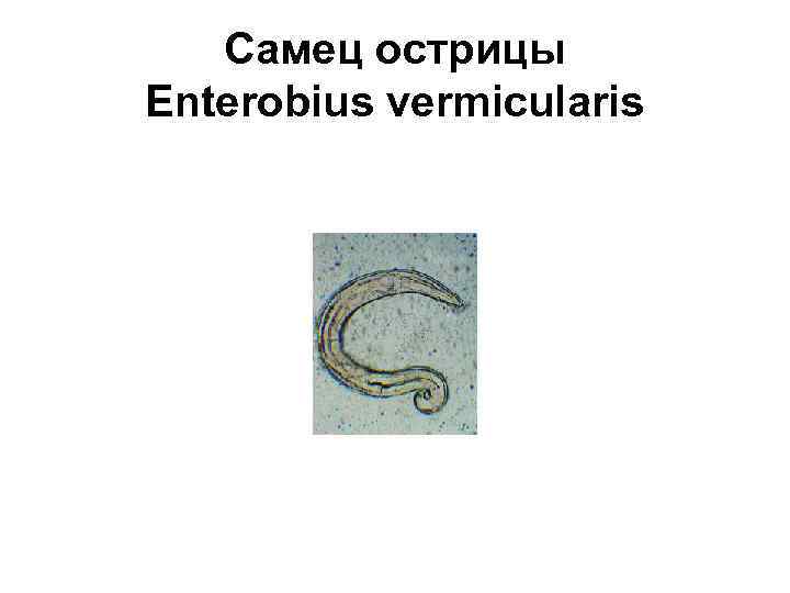 Самец острицы Enterobius vermicularis 