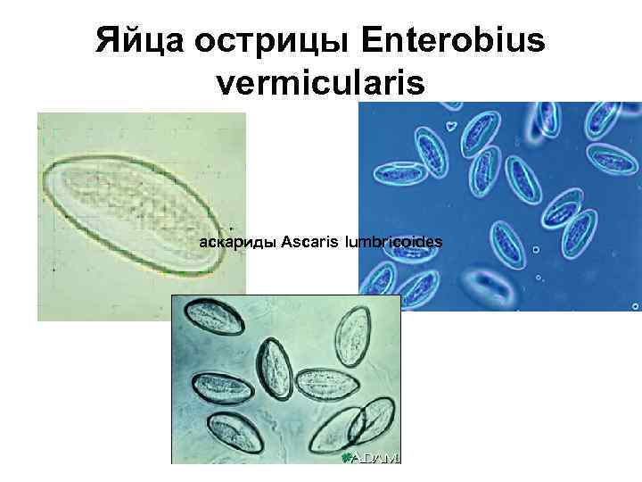 Яйца острицы Enterobius vermicularis аскариды Ascaris lumbricoides 