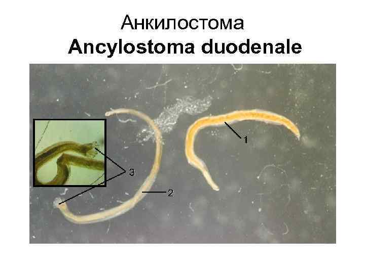 Анкилостома Ancylostoma duodenale 